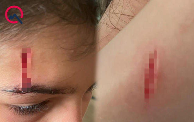 “Bina baxımsızdır, qırıq şüşələr uşaqları yaralayıb” - FOTOLAR