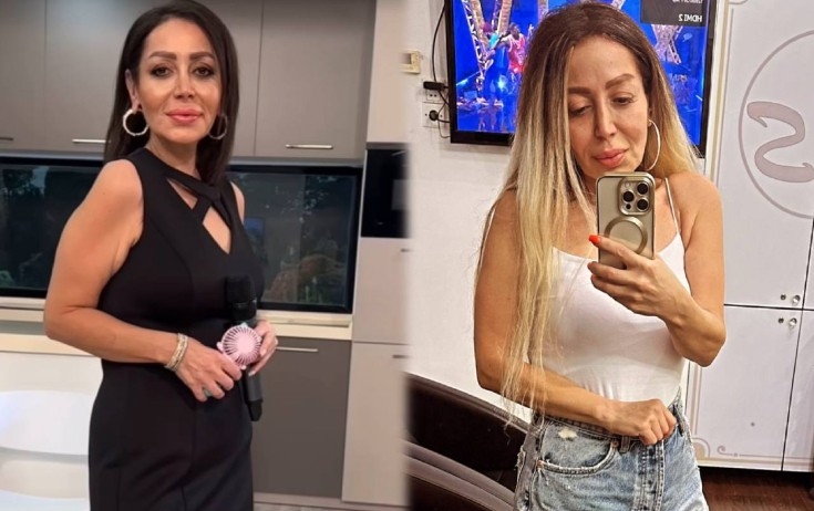 Emma Ələkbərzadə belə dəyişdi - FOTO