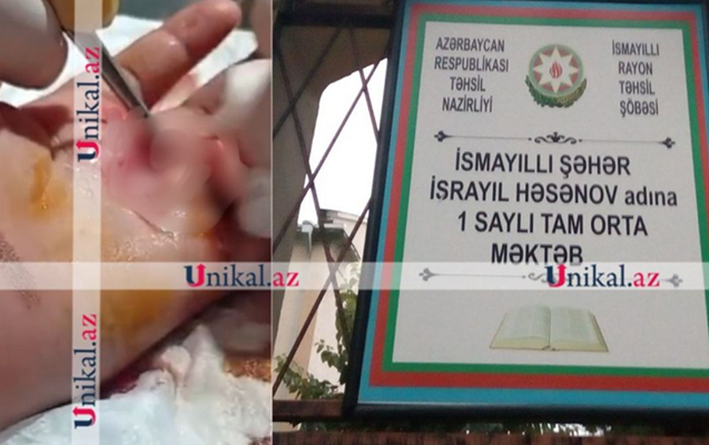Məktəbdəki insidentlə bağlı - Rəsmi açıqlama