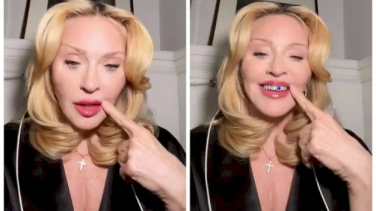 Madonna brilyant dişlərini göstərdi