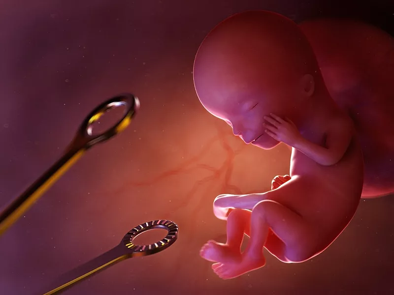 Azərbaycanda abortların sayı 5 minə yaxın artıb