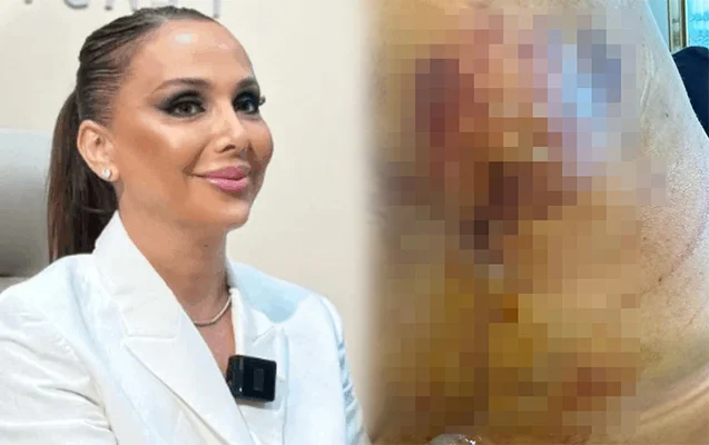 “Həkim məni 3 dəfə əməliyyat edib pis vəziyyətə qoydu” - FOTO