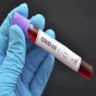Növbəti koronavirus pandemiyası GƏLİR