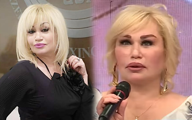 “Plastik əməliyyatda sinirimə toxunulub...”