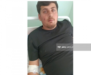 Dron hücumunda yaralanan Azərbaycan vətəndaşı: "Hər şey yaxşıdır" - VİDEO