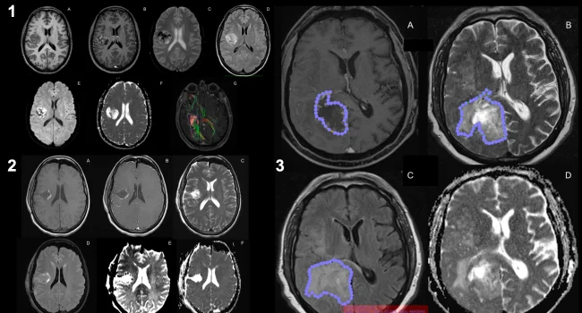 Həkimlərin 12 günə qoyduğu diaqnozu süni intellekt 12 dəqiqədə QOYDU