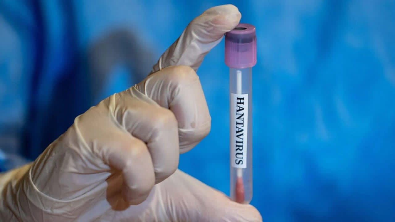 ÜST-ün baş direktoru hantavirus təhlükəsindən danışdı